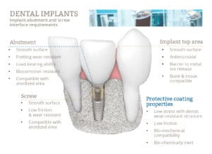 diagram of teeth with implant