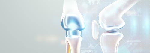 rendering of a knee replacement