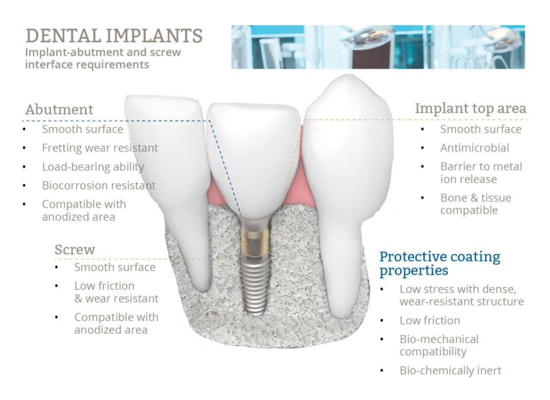 Increase Implant Longevity with Biofunctional Dental Implant